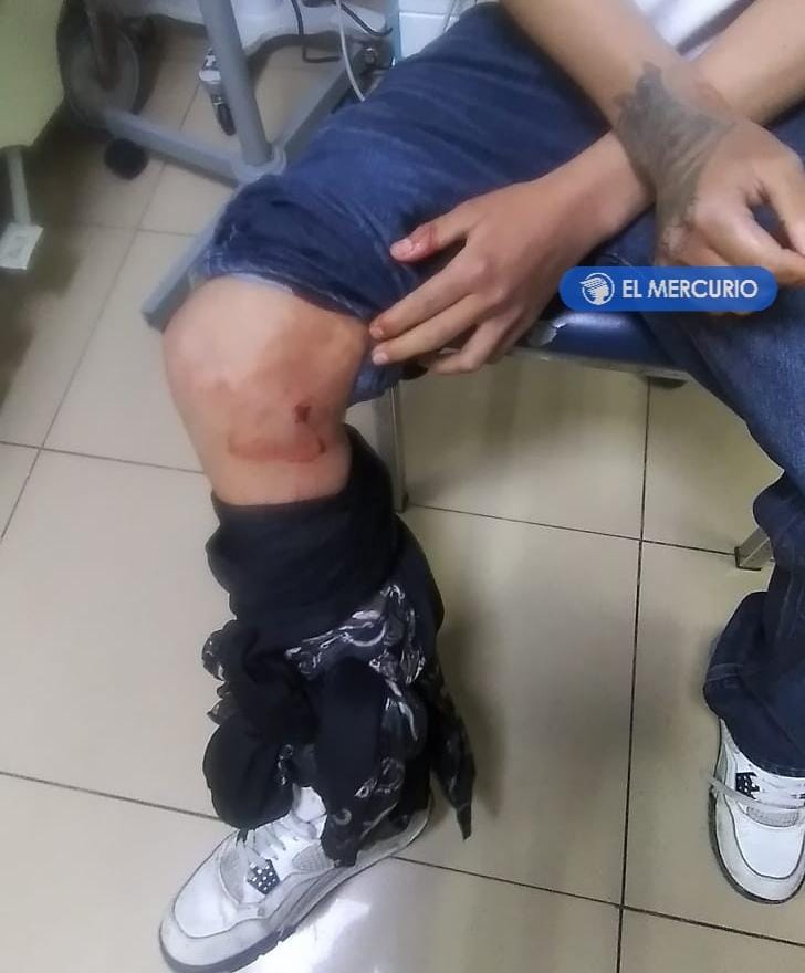 Joven de 16 años resulta herido al recibir un disparo, en Cuenca