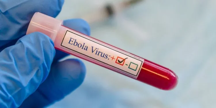 El brote de ébola en Uganda acumula 130 casos confirmados y 43 muertes