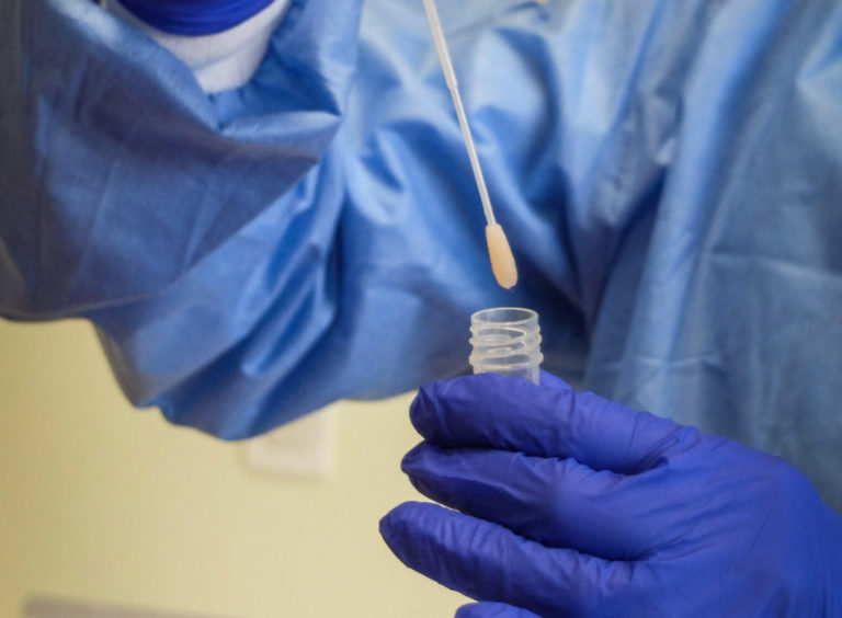 Laboratorio en Cuenca cobrará USD 200 por prueba del coronavirus