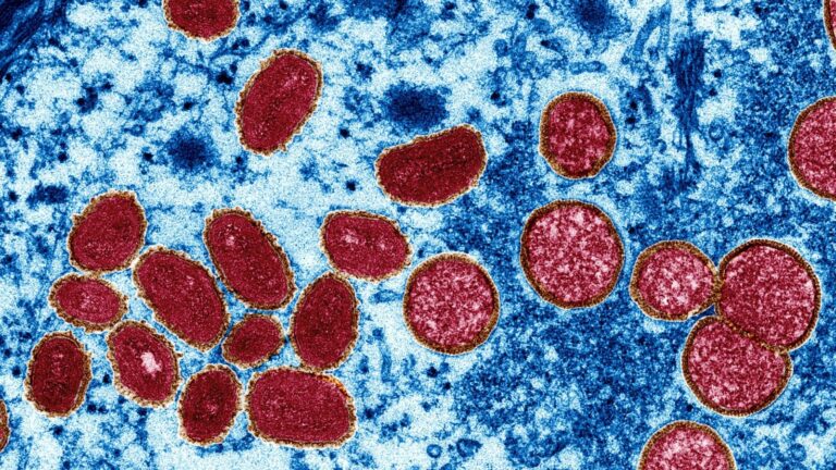 Perú logra secuenciar virus de la viruela del mono del primer caso confirmado