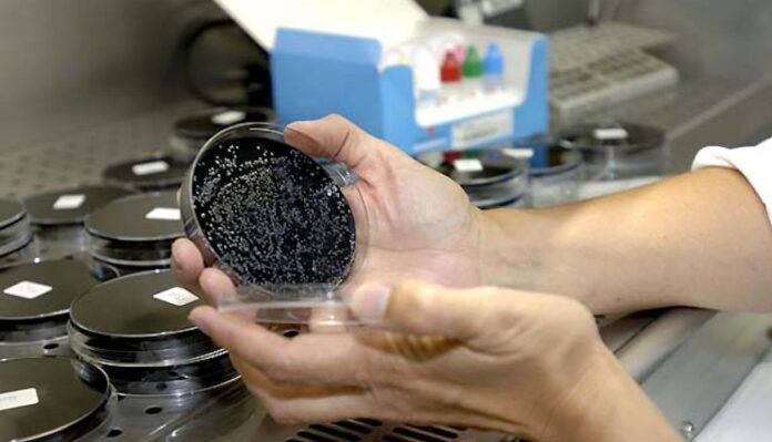 bacteria-legionella