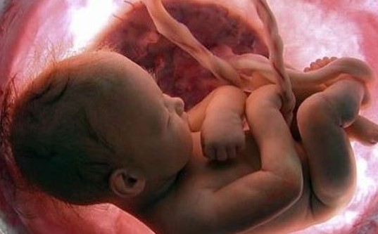 Usar embriones congelados puede elevar el riesgo de hipertensión en embarazo