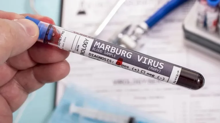 OMS dice avanzan preparativos de ensayos de vacunas contra virus de marburgo