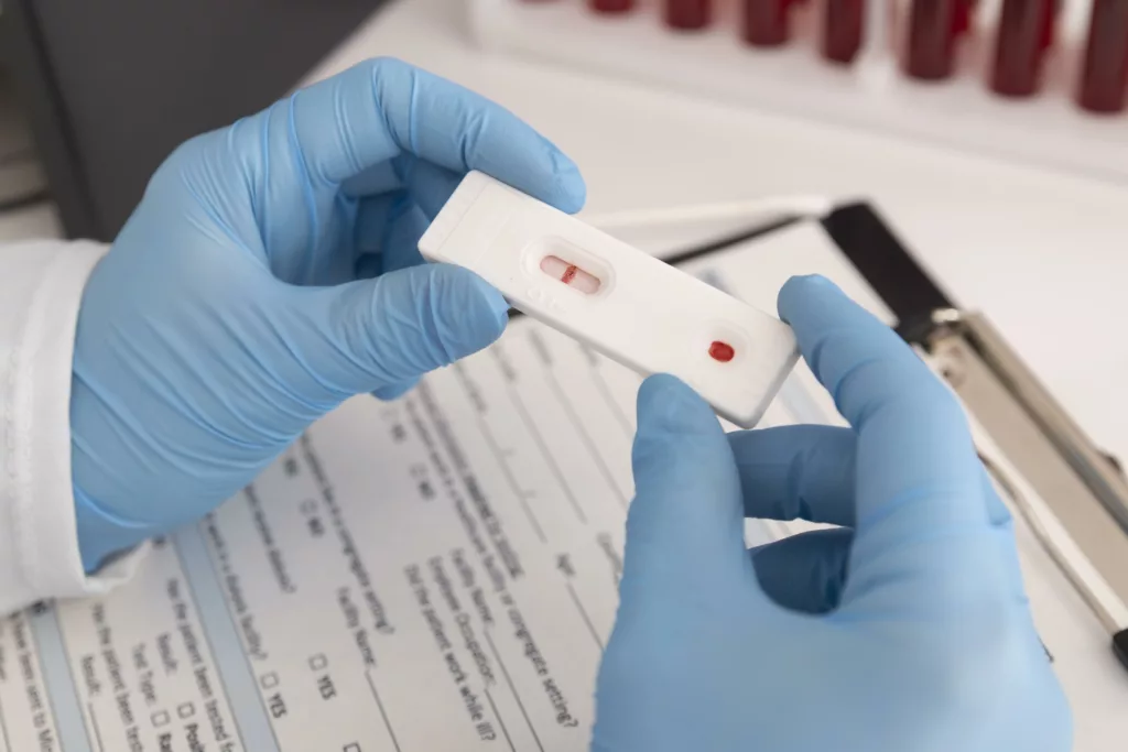 Imagen referencial. La región europea necesita ampliar los servicios de test del Virus de Inmunodeficiencia Humana (VIH) y de tratamiento del sida para poder alcanzar el objetivo de la ONU de acabar con esta enfermedad en 2030. Foto: Freepik