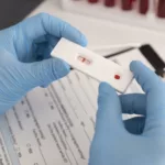 Imagen referencial. La región europea necesita ampliar los servicios de test del Virus de Inmunodeficiencia Humana (VIH) y de tratamiento del sida para poder alcanzar el objetivo de la ONU de acabar con esta enfermedad en 2030. Foto: Freepik