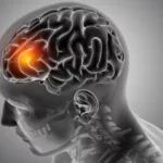 Imagen referencial. Los ictus o accidentes cerebrovasculares podrían causar casi 10 millones de muertes al año para 2050. Foto: Freepik