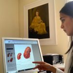 La especialista María Caridad Manzano hizo recomendaciones sobre el cuidado del riñón sobre consumo de alimentos en Cuenca.