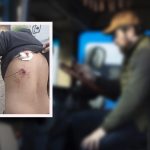 El conductor del vehículo particular resultó herido por una aparente arma de fogueo, según la Policía.