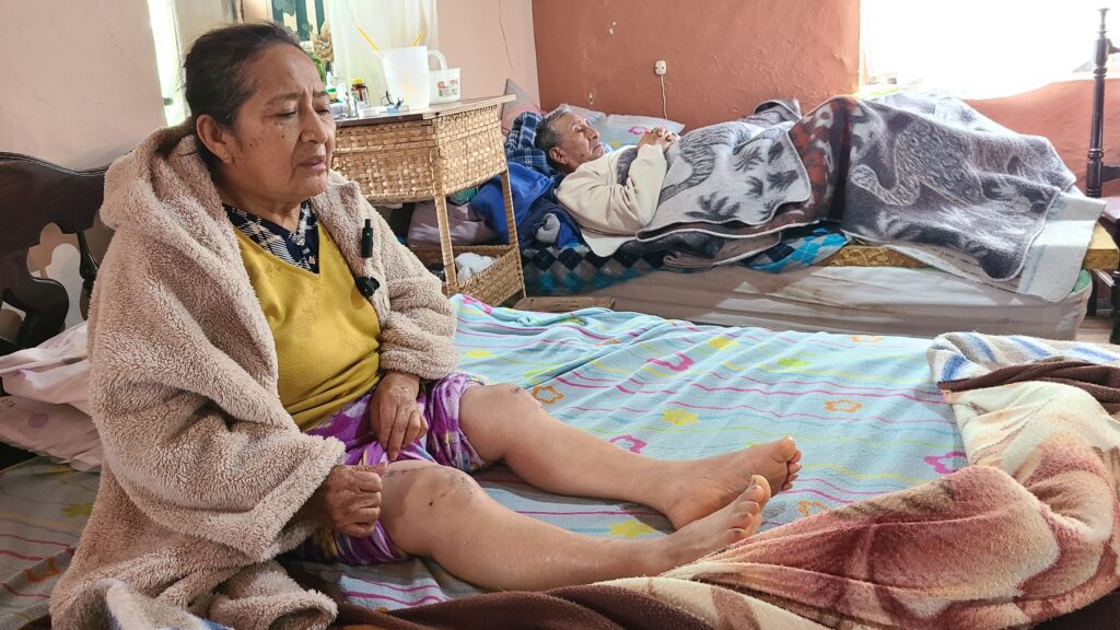 María Chuqui, de 69 años, y Miguel Clavijo de 72 años, están postrados en una cama, tras ser impactados por un patrullero de la Policía Nacional.