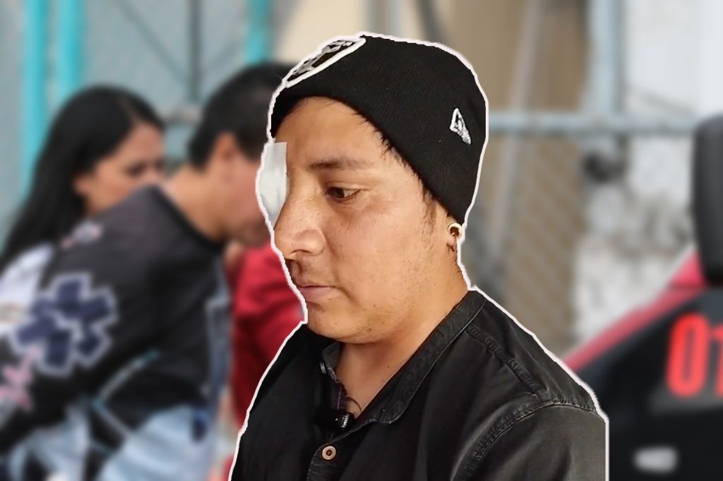 Familiares de Edison Pilataxi lo acompañan en su recuperación tras su cirugía.