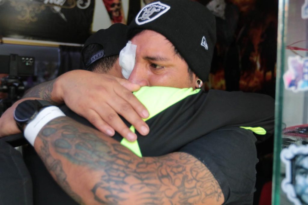 Edison Pilataxi pide que se haga justicia tras la agresión que le hizo perder su ojo derecho.