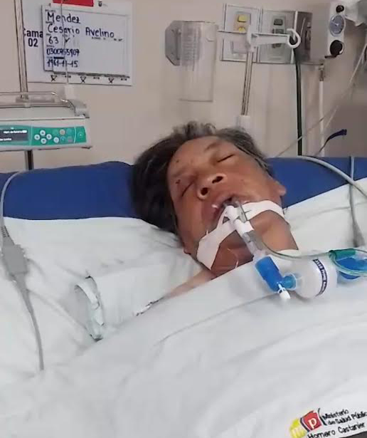 Víctima del atropello en Guapán, Azogues.