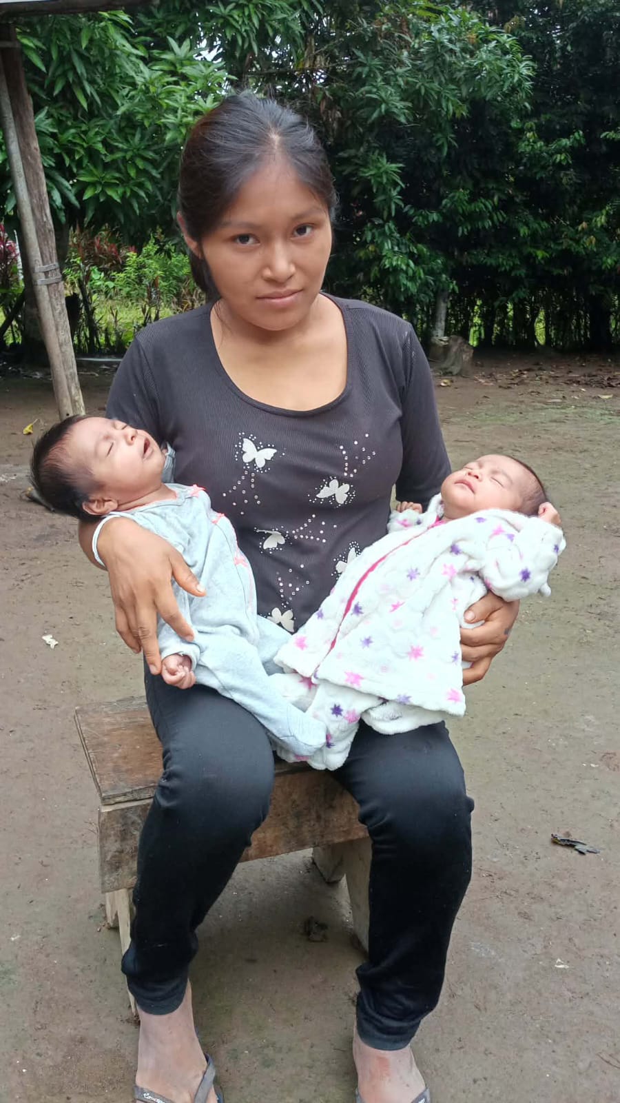 Mellizos llegaron de Taisha a Cuenca y luchan por su vida. Están internados en el Vicente Corral y en el José Carrasco.